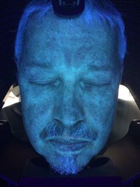 VISIAの表面走査器の分析魔法ミラーの皮の検光子の博士機能セリウムFCCのための診療所 Usd 3D専門の皮のテスター