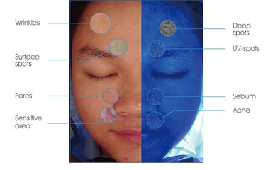 化粧品のProfessional Skin Analysis Facial博士の検光子3Dの表面検光子魔法ミラーの皮の検光子の白いセリウムのFDAのため