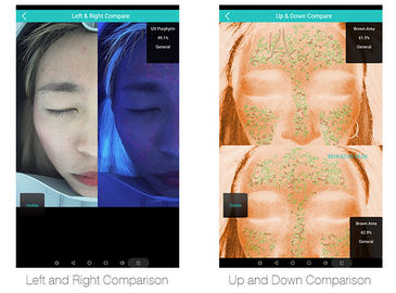 化粧品のProfessional Skin Analysis Facial博士の検光子3Dの表面検光子魔法ミラーの皮の検光子の白いセリウムのFDAのため