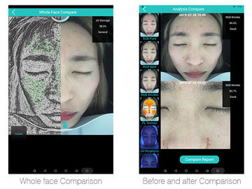 30，000,000の臨床データベースが付いているUse 3Dの表面家の検光子を博士