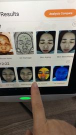 療法士のスマートな皮の検光子は深い皮問題のセリウムの証明書を検出します