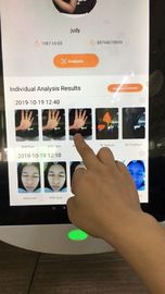 韓国の博士のための診療所顔の解析システムのデジタル64gb貯蔵