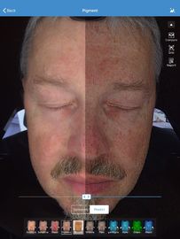 博士のためのSkin 診療所 3d皮の検光子の走査器のVisia顔32gbの貯蔵