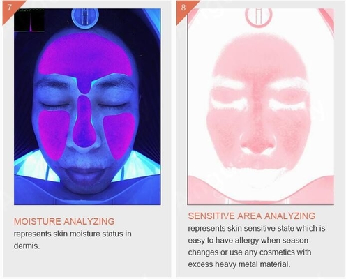 Skincareのしわの色素形成のアクネの皮の検光子機械3Dスマートなクイズ