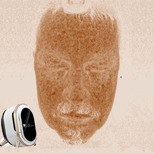 専門の携帯用皮の検光子、顔の皮の分析110-220Vの電圧